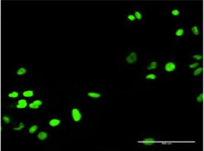 Immunocytochemistry/Immunofluorescence: RECQ1 Antibody [H00005965-D01P] - HeLa cell. 