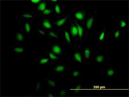 Immunocytochemistry/Immunofluorescence: RGL4 Antibody [H00266747-B01] - Rgr ( Cat# H00266747-B01 ) on HeLa cell . [antibody concentration 10 ug/ml]