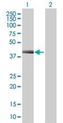 Western Blot: Complement Factor H-related 1/CFHR1/CFHL1 Antibody [H00003078-B02] - Analysis of CFHL1 expression in transfected 293T cell line by CFHL1 MaxPab polyclonal antibody (B02). Lane 1: CFHL1 transfected lysate (37.70 KDa). Lane 2: Non-transfected lysate.