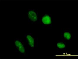 Immunocytochemistry/Immunofluorescence: TRUB1 Antibody [H00142940-B01] - Immunofluorescence of purified MaxPab antibody to TRUB1 on HeLa cell. [antibody concentration 10 ug/ml]