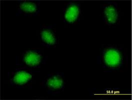 Immunocytochemistry/Immunofluorescence: ZNF396 Antibody [H00252884-B01] - Immunofluorescence of purified MaxPab antibody to ZNF396 on HeLa cell. [antibody concentration 10 ug/ml]