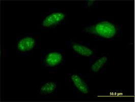 Immunocytochemistry/Immunofluorescence: DDX50 Antibody [H00079009-B01] - Immunofluorescence of purified MaxPab antibody to DDX50 on HeLa cell. [antibody concentration 10 ug/ml]