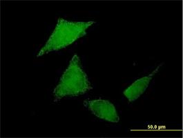 Immunocytochemistry/Immunofluorescence: SgK071 Antibody [H00169436-B01P] - Immunofluorescence of purified MaxPab antibody to C9orf96 on HeLa cell. [antibody concentration 10 ug/ml]