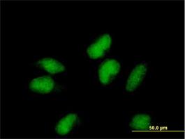 Immunocytochemistry/Immunofluorescence: ZNF41 Antibody [H00007592-B01] - Immunofluorescence of purified MaxPab antibody to ZNF41 on HeLa cell. [antibody concentration 10 ug/ml]