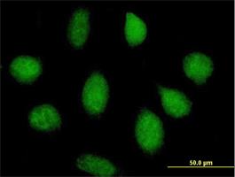 Immunocytochemistry/Immunofluorescence: ABRO Antibody [H00023172-B01] - Immunofluorescence of purified MaxPab antibody to KIAA0157 on HeLa cell. [antibody concentration 10 ug/ml]