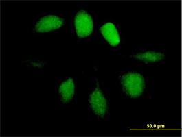 Immunocytochemistry/Immunofluorescence: UBL4A Antibody [H00008266-B01] - UBL4A (Cat# H00008266-B01) on HeLa cell . [antibody concentration 10 ug/ml]