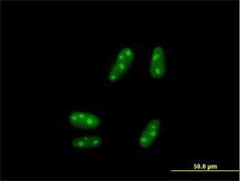 Immunocytochemistry/Immunofluorescence: SSX5 Antibody [H00006758-B01P] - Immunofluorescence of purified MaxPab antibody to SSX5 on HepG2 cell. [antibody concentration 10 ug/ml]