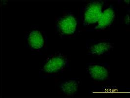 Immunocytochemistry/Immunofluorescence: CBX6 Antibody [H00023466-B01] - Immunofluorescence of purified MaxPab antibody to CBX6 ( Cat# H00023466-B01 ) on HeLa cell . [antibody concentration 10 ug/ml]