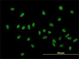 Immunocytochemistry/Immunofluorescence: ZHX1 Antibody [H00011244-B01] - Immunofluorescence of purified MaxPab antibody to ZHX1 on HeLa cell. [antibody concentration 10 ug/ml]