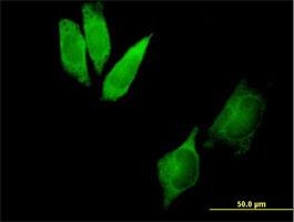 Immunocytochemistry/Immunofluorescence: DYNC1I2 Antibody [H00001781-B01P] - Immunofluorescence of purified MaxPab antibody to DYNC1I2 on HeLa cell. [antibody concentration 10 ug/ml]