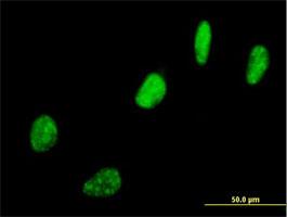 Immunocytochemistry/Immunofluorescence: SNURF Antibody [H00008926-B01] - Immunofluorescence of purified MaxPab antibody to SNURF on HeLa cell. [antibody concentration 10 ug/ml]