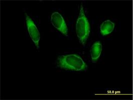 Immunocytochemistry/Immunofluorescence: ALG1 Antibody [H00056052-B01] - Immunofluorescence of purified MaxPab antibody to ALG1 on HeLa cell. [antibody concentration 10 ug/ml]