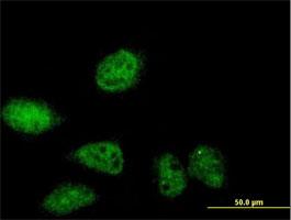 Immunocytochemistry/Immunofluorescence: SERTAD2 Antibody [H00009792-B01] - Immunofluorescence of purified MaxPab antibody to SERTAD2 on HeLa cell. [antibody concentration 10 ug/ml]