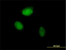 Immunocytochemistry/Immunofluorescence: ZNF215 Antibody [H00007762-B01] - ZNF215 ( Cat# H00007762-B01 ) on HeLa cell . [antibody concentration 10 ug/ml]