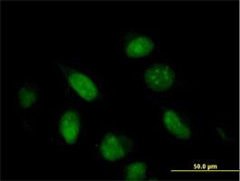 Immunocytochemistry/Immunofluorescence: BUD31 Antibody [H00008896-B02] - Immunofluorescence of purified MaxPab antibody to G10 (Cat# H00008896-B02) on HeLa cell . [antibody concentration 10 ug/ml]
