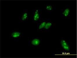 Immunocytochemistry/Immunofluorescence: MPHOSPH6 Antibody [H00010200-B01] - Immunofluorescence of purified MaxPab antibody to MPHOSPH6 on HeLa cell. [antibody concentration 10 ug/ml]