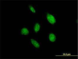 Immunocytochemistry/Immunofluorescence: OVOL2 Antibody [H00058495-B02] - Immunofluorescence of purified MaxPab antibody to OVOL2 ( Cat# H00058495-B02 ) on HeLa cell . [antibody concentration 10 ug/ml]