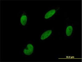 Immunocytochemistry/Immunofluorescence: GTF2A2 Antibody [H00002958-B02] - Immunofluorescence of purified MaxPab antibody to GTF2A2 on HepG2 cell. [antibody concentration 10 ug/ml]