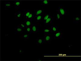 Immunocytochemistry/Immunofluorescence: MAD3 Antibody [H00083463-B01] - Immunofluorescence of purified MaxPab antibody to MXD3 ( Cat# H00083463-B01 ) on HeLa cell . [antibody concentration 10 ug/ml]