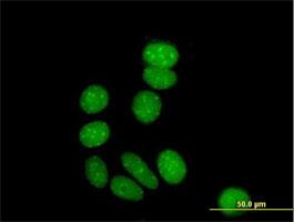 Immunocytochemistry/Immunofluorescence: ZNF354A Antibody [H00006940-B01] - Immunofluorescence of purified MaxPab antibody to ZNF354A on MCF-7 cell. [antibody concentration 10 ug/ml]