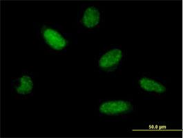 Immunocytochemistry/Immunofluorescence: Tryptophan rich protein Antibody [H00007485-B01] - Immunofluorescence of purified MaxPab antibody to WRB on HeLa cell. [antibody concentration 10 ug/ml]