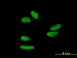 Immunocytochemistry/Immunofluorescence: ZNF398 Antibody [H00057541-B01] - Immunofluorescence of purified MaxPab antibody to ZNF398 on HepG2 cell. [antibody concentration 10 ug/ml]