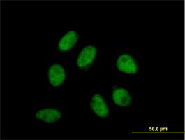 Immunocytochemistry/Immunofluorescence: Apc4 Antibody [H00029945-B01] - Immunofluorescence of purified MaxPab antibody to ANAPC4 on HeLa cell. [antibody concentration 10 ug/ml]