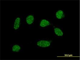 Immunocytochemistry/Immunofluorescence: KxDL motif containing 1 Antibody [H00079036-B01] - Immunofluorescence of purified MaxPab antibody to C19orf50 on HeLa cell. [antibody concentration 10 ug/ml]