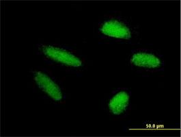 Immunocytochemistry/Immunofluorescence: TRIM46 Antibody [H00080128-B01] - Immunofluorescence of purified MaxPab antibody to TRIM46 on HepG2 cell. [antibody concentration 20 ug/ml]