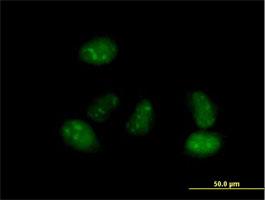 Immunocytochemistry/Immunofluorescence: ALS2CR15 Antibody [H00130026-B01] - Immunofluorescence of purified MaxPab antibody to ALS2CR15 on HeLa cell. [antibody concentration 10 ug/ml]
