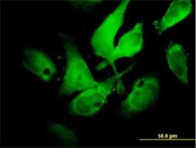 Immunocytochemistry/Immunofluorescence: p67phox/NOXA2 Antibody [H00004688-B01] - Immunofluorescence of purified MaxPab antibody to NCF2 (Cat# H00004688-B01) on HeLa cell . [antibody concentration 10 ug/ml]