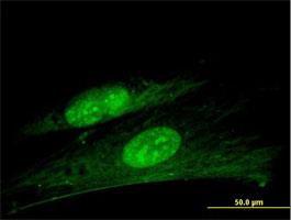 Immunocytochemistry/Immunofluorescence: ANKRD7 Antibody [H00056311-B01] - Immunofluorescence of purified MaxPab antibody to ANKRD7 on Hs 181.Tes cell. [antibody concentration 10 ug/ml]