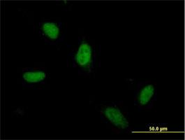 Immunocytochemistry/Immunofluorescence: ZSCAN5 Antibody [H00079149-B01] - ZSCAN5 ( Cat# H00079149-B01 ) on HeLa cell . [antibody concentration 10 ug/ml]