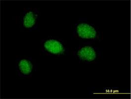 Immunocytochemistry/Immunofluorescence: CDYL2 Antibody [H00124359-B01P] - Immunofluorescence of purified to CDYL2 on formalin-fixed paraffin-embedded HeLa cell. [antibody concentration 10 ug/ml]