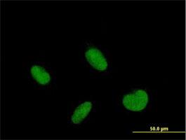 Immunocytochemistry/Immunofluorescence: ZNF223 Antibody [H00007766-B01] - Immunofluorescence of purified MaxPab antibody to ZNF223 on HepG2 cell. [antibody concentration 10 ug/ml]