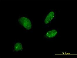Immunocytochemistry/Immunofluorescence: DCTN3 Antibody [H00011258-B01] - Immunofluorescence of purified MaxPab antibody to DCTN3 on HeLa cell. [antibody concentration 10 ug/ml]