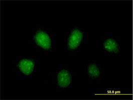Immunocytochemistry/Immunofluorescence: PARP3 Antibody [H00010039-B01P] - Immunofluorescence of purified MaxPab antibody to PARP3 on HeLa cell. [antibody concentration 10 ug/ml]