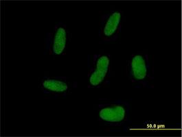 Immunocytochemistry/Immunofluorescence: ZNF239 Antibody [H00008187-B01] - Immunofluorescence of purified MaxPab antibody to ZNF239 on HepG2 cell. [antibody concentration 10 ug/ml]