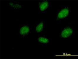 Immunocytochemistry/Immunofluorescence: RHOXF2 Antibody [H00084528-B02] - PEPP-2 ( Cat# H00084528-B02 ) on HeLa cell . [antibody concentration 10 ug/ml]