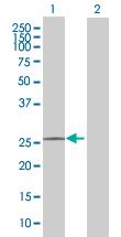 Western Blot: C9orf152 Antibody [H00401546-B01] - analysis of C9orf152 expression in transfected 293T cell line by C9orf152 MaxPab polyclonal antibody (B01). Lane 1: C9orf152 transfected lysate (23.90 KDa). Lane 2: Non-transfected lysate.