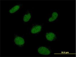 Immunocytochemistry/Immunofluorescence: RNF113A Antibody [H00007737-B01] - Immunofluorescence of purified MaxPab antibody to RNF113A on HeLa cell. [antibody concentration 7 ug/ml]