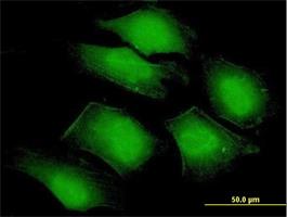 Immunocytochemistry/Immunofluorescence: PDLIM3 Antibody [H00027295-B02] - Immunofluorescence of purified MaxPab antibody to PDLIM3 on HeLa cell. [antibody concentration 10 ug/ml]