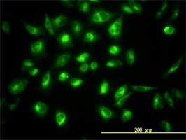 Immunocytochemistry/Immunofluorescence: COG7 Antibody (3G4-1B3) [H00091949-M01] - Immunofluorescence of monoclonal antibody to COG7 (H00091949-M01) on HeLa cell. [antibody concentration 10ug/ml]