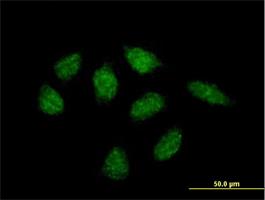 Immunocytochemistry/Immunofluorescence: MARCH10 Antibody [H00162333-B01] - Immunofluorescence of purified MaxPab antibody to RNF190 on HeLa cell. [antibody concentration 20 ug/ml]