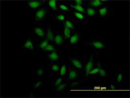 Immunocytochemistry/Immunofluorescence: PSRC2 Antibody [H00196441-B01] - Immunofluorescence of purified MaxPab antibody to PSRC2 (Cat# H00196441-B01) on HeLa cell . [antibody concentration 10 ug/ml]