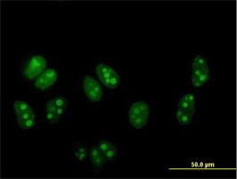 Immunocytochemistry/Immunofluorescence: DDX54 Antibody [H00079039-B01] - Immunofluorescence of purified MaxPab antibody to DDX54 on HeLa cell. [antibody concentration 10 ug/ml]
