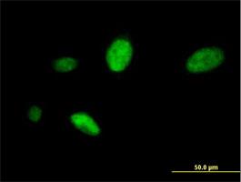 Immunocytochemistry/Immunofluorescence: PKNOX1 Antibody [H00005316-B01] - Immunofluorescence of purified MaxPab antibody to PKNOX1 ( Cat# H00005316-B01 ) on HeLa cell . [antibody concentration 10 ug/ml]