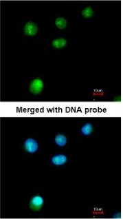 Immunocytochemistry/Immunofluorescence: RB1CC1 Antibody [NBP1-31583] - Paraformaldehyde-fixed A549, using antibody at 1:200 dilution.