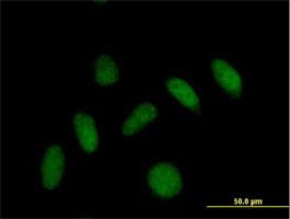 Immunocytochemistry/Immunofluorescence: GNRPX Antibody [H00055111-B01] - Immunofluorescence of purified MaxPab antibody to PLEKHJ1 on HeLa cell. [antibody concentration 10 ug/ml]