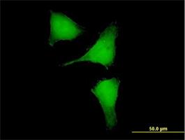 Immunocytochemistry/Immunofluorescence: RPRD2 Antibody [H00023248-B01] - Immunofluorescence of purified MaxPab antibody to KIAA0460 on HeLa cell. [antibody concentration 10 ug/ml]